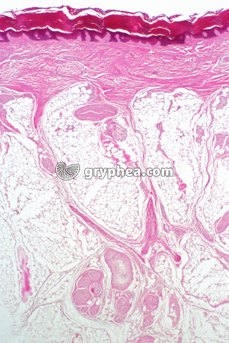 Peau avec corpuscule de Pacini x7 - gryphea.org